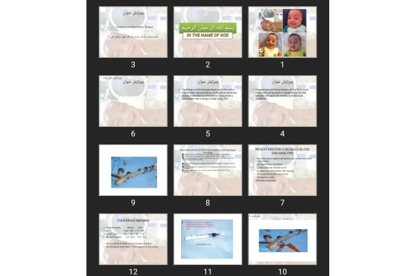پاورپوینت Umbilical cord Blood Gases analysis