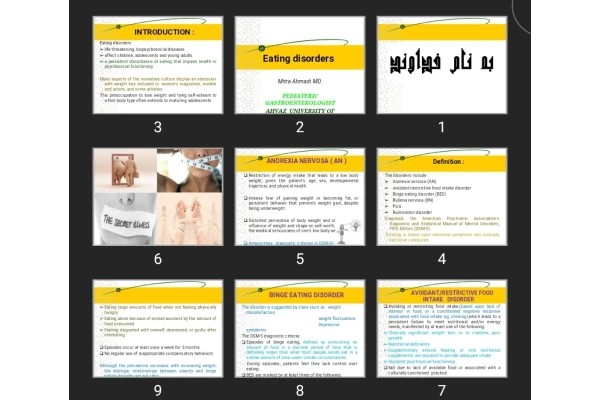 پاورپوینت Eating disorders