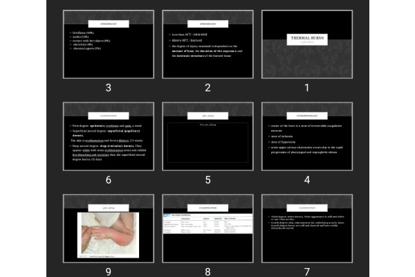 پاورپوینت THERMAL BURNS