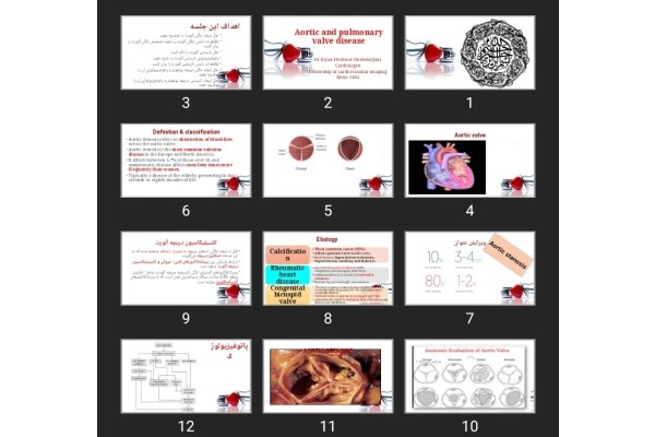 پاورپوینت Aortic and pulmonary valve disease