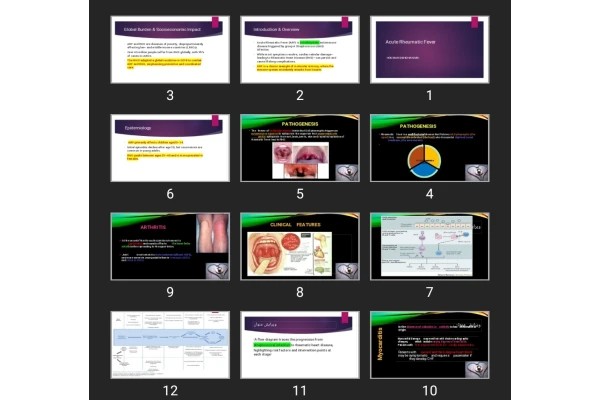پاورپوینت Acute Rheumatic Fever