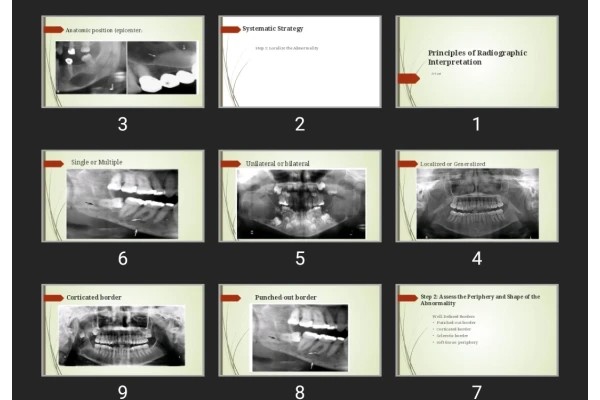 پاورپوینت Principles of Radiographic Interpretation
