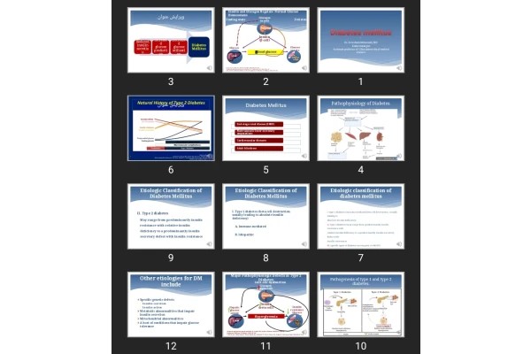 پاورپوینت Diabetes mellitus
