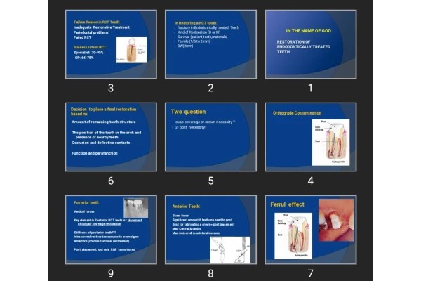 پاورپوینت Restoration of Endodontically treated Teeth