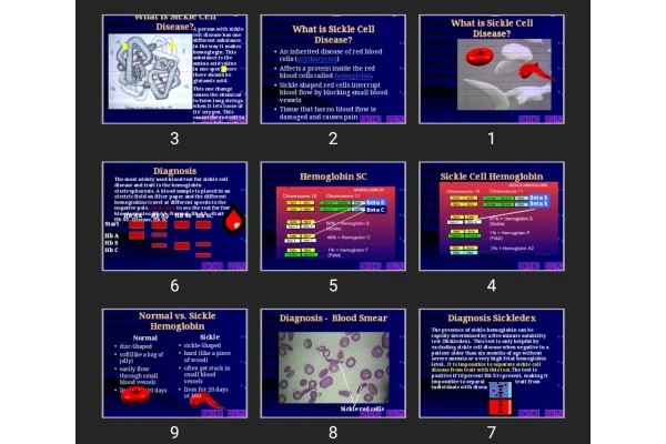 پاورپوینت What is Sickle Cell Disease