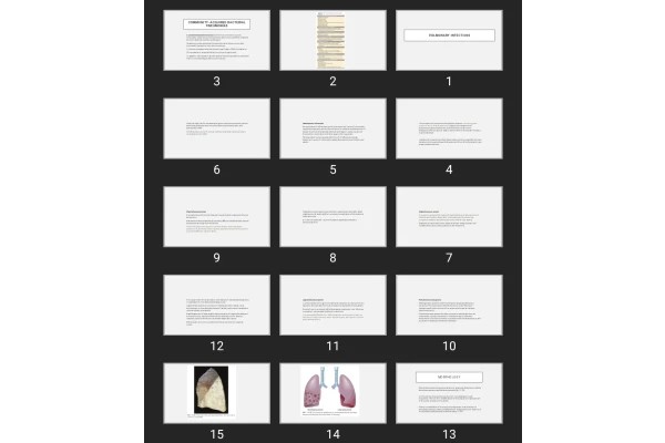 پاورپوینت PULMONARY INFECTIONS