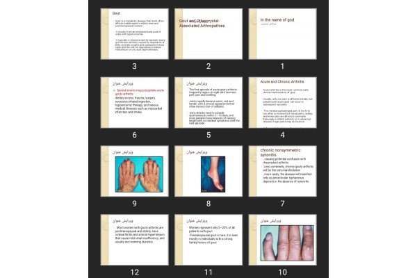 پاورپوینت Gout and Othercrystal-Associated Arthropathies