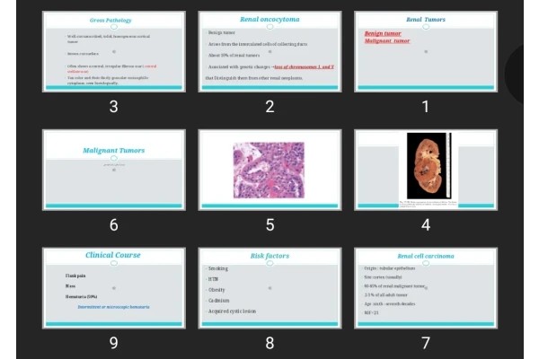 پاورپوینت Renal Tumors