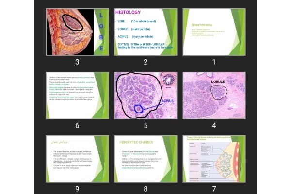 پاورپوینت Breast disease