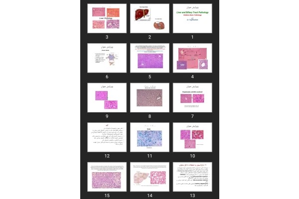 پاورپوینت Liver and Biliary Tract Pathology Robbins Basic Pathology