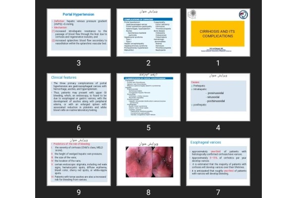 پاورپوینت CIRRHOSIS AND ITS COMPLICATIONS