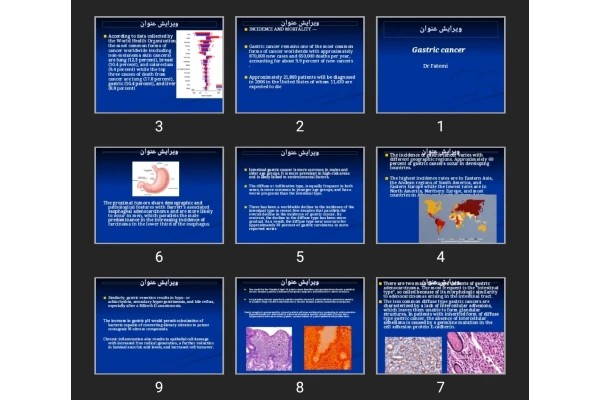 اورپوینت Gastric cancer