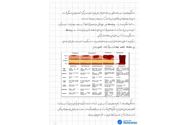 جزوه سوختگی