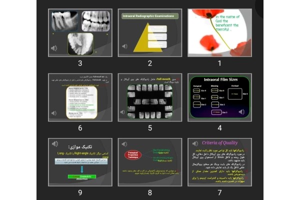 پاورپوینت Intraoral principles and errors