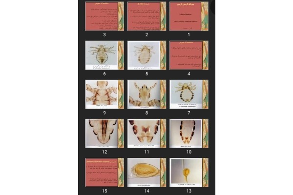 پاورپوینت (Lice) شپش ها