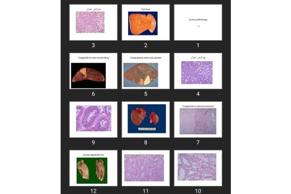پاورپوینت Gross pathology