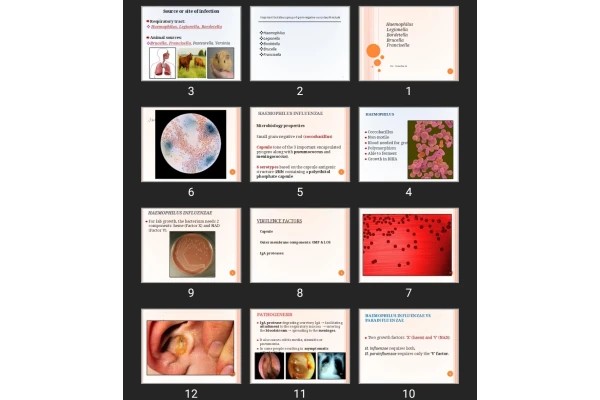 پاورپوینت کودک Haemophilus Legionella Bordetella Brucella Francisella
