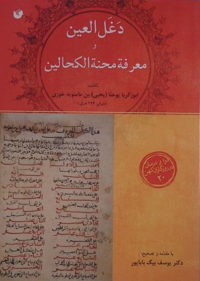 دغل العین و معرفة محنة الکحالین