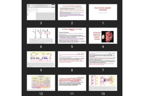 پاورپوینت POLYCYSTIC KIDNEY DISEASES