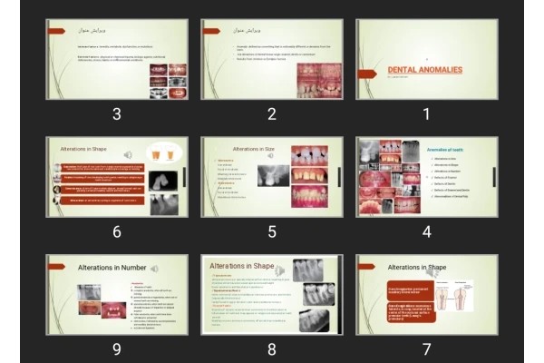 پاورپوینت DENTAL ANOMALIES