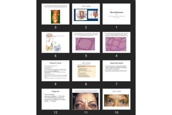 پاورپوینت Thyroid Diseases