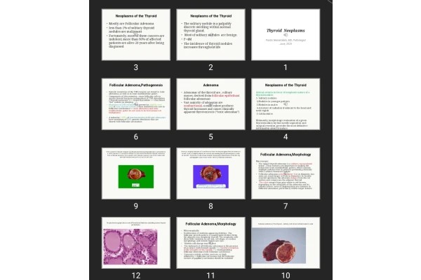 پاورپوینت Thyroid Neoplasms