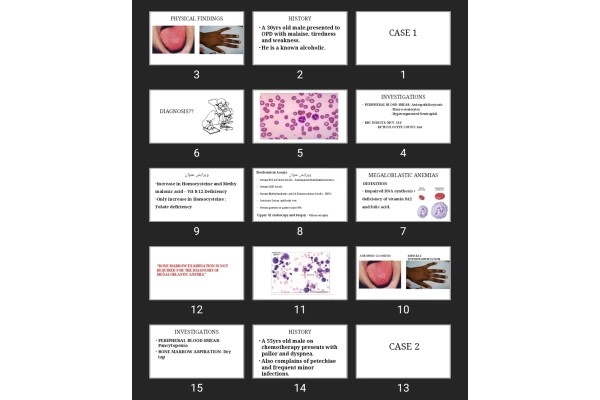 پاورپوینت Hematology case study