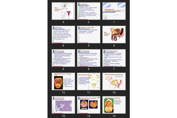 پاورپوینت Pathology of Prostatic Enlargement