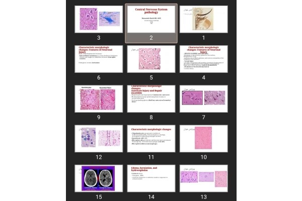 پاورپوینت Central Nervous System pathology