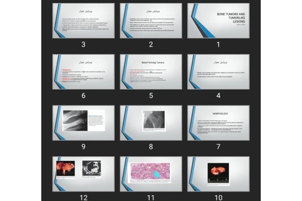 پاورپوینت BONE TUMORS AND TUMORLIKE LESIONS