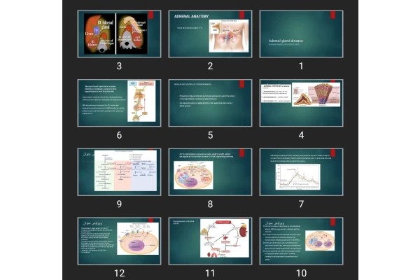 پاورپوینت Adrenal gland disease