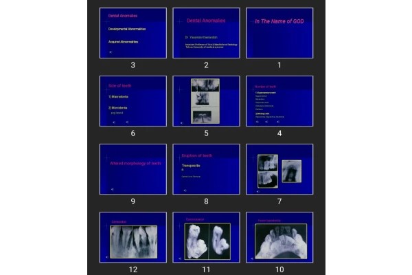 پاورپوینت Dental Anomalies
