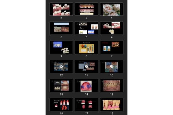 پاورپوینت PRINCIPLES OF TOOTH PREPARATION