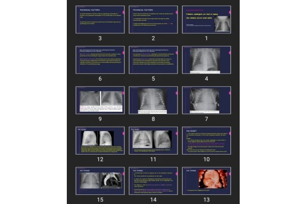 پاورپوینت Pediatric radiologists are fond of saying that children are not small adults