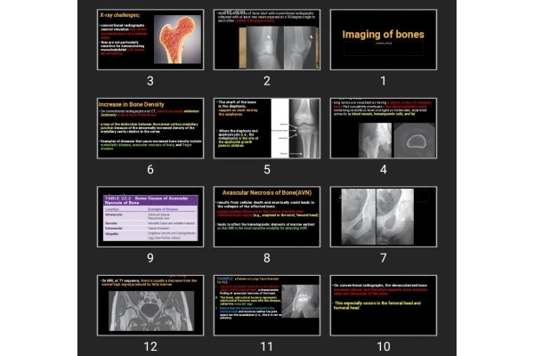 پاورپوینت Imaging of bones