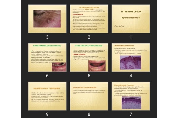 پاورپوینت Epithelial lesions 6