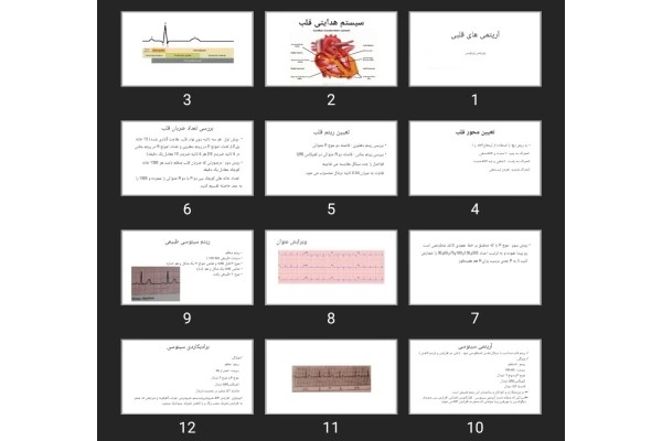 پاورپوینت آریتمی های قلبی