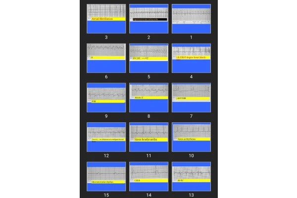 پاورپوینت Strip Test