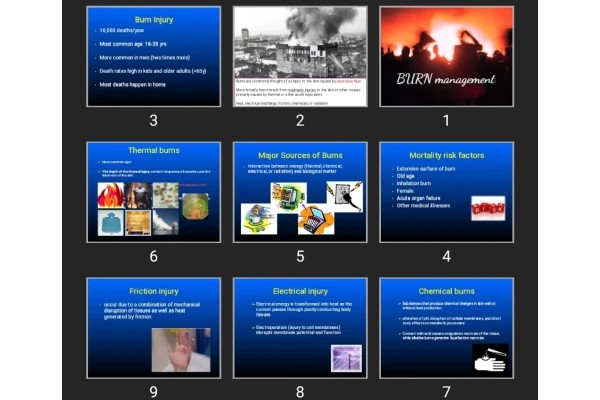 پاورپوینت BURN management