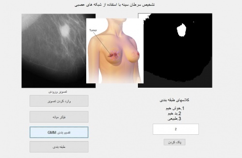 طبقه بندی سرطان سینه با استفاده از شبکه‌های عصبی (GUI متلب) - اسمارت فایل