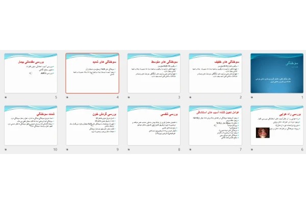 پاورپوینت سوختگی