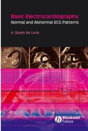 دانلود کتاب Basic Electrocardiography Normal and Abnormal ECG Patterns deLuna