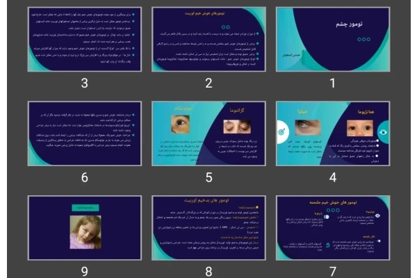 پاورپوینت تومور چشم