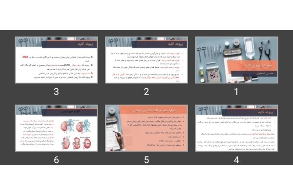پاورپوینت پیوند کلیه