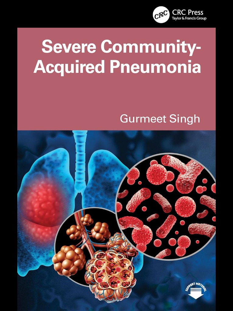 Severe Community Acquired Pneumonia 2025
