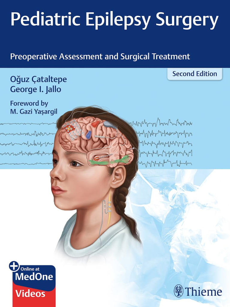 Pediatric Epilepsy Surgery: Preoperative Assessment and Surgical Treatment +Video 2020