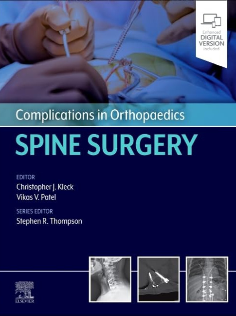 Complications in Orthopaedics: Spine Surgery 2025 1st Edition