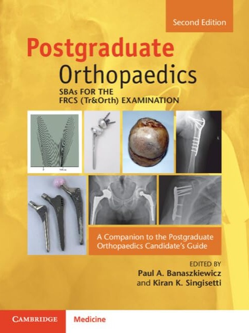 SBAs for the FRCS (Tr&Orth) Examination: A Companion to the Postgraduate Orthopaedics Candidate's Guide 2025 2nd Edition