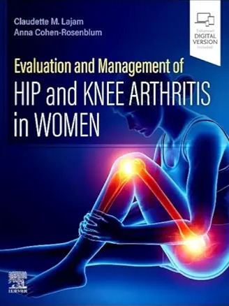 Evaluation and Management of Hip and Knee Arthritis in Women 2026 1st Edition