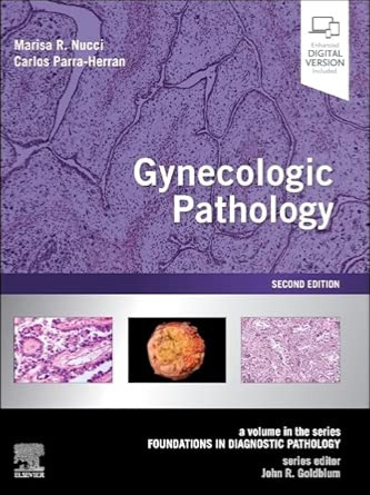 Gynecologic Pathology: A Volume in Foundations in Diagnostic Pathology Series 2021
